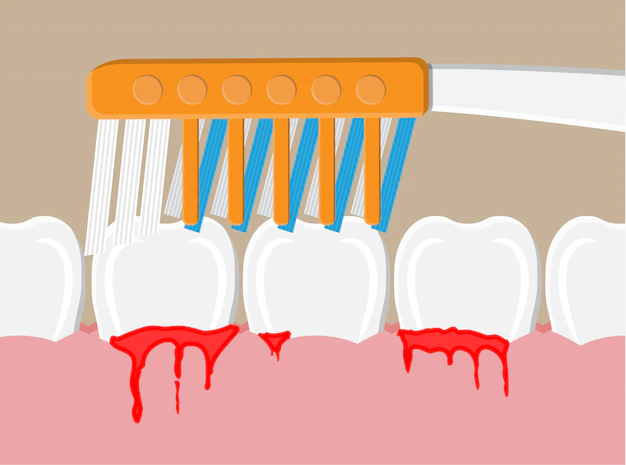 Treatment Of Gum Diseases